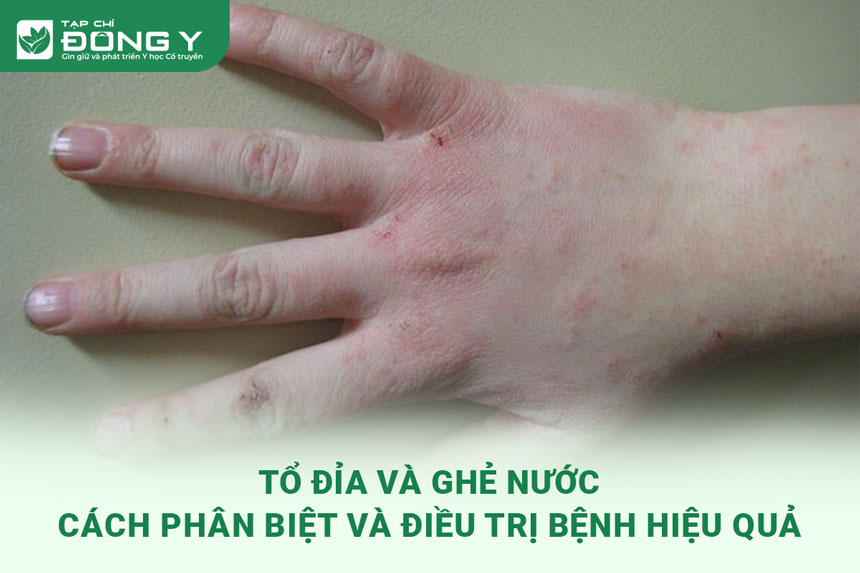 to-dia-va-ghe-nuoc
