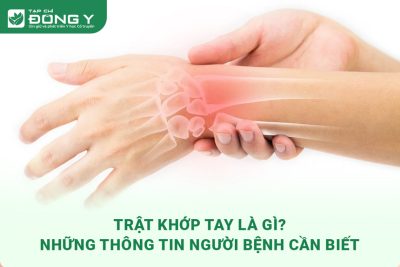 trat-khop-tay