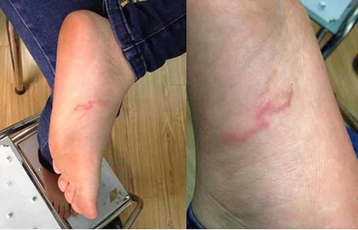 Các bệnh lý bên trong cơ thể có thể gây ra mẩn ngứa