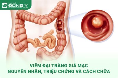 viem-dai-trang-gia-mac