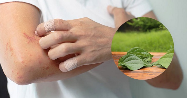 Bôi lá trầu không lên vùng da bị viêm