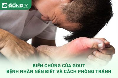 bien-chung-cua-gout