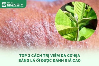 cach-tri-viem-da-co-dia-bang-la-oi