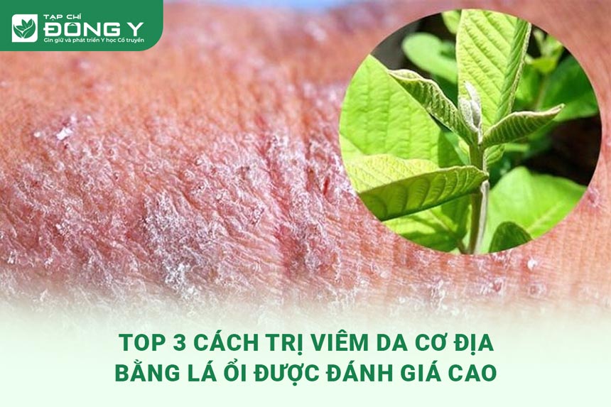 cach-tri-viem-da-co-dia-bang-la-oi