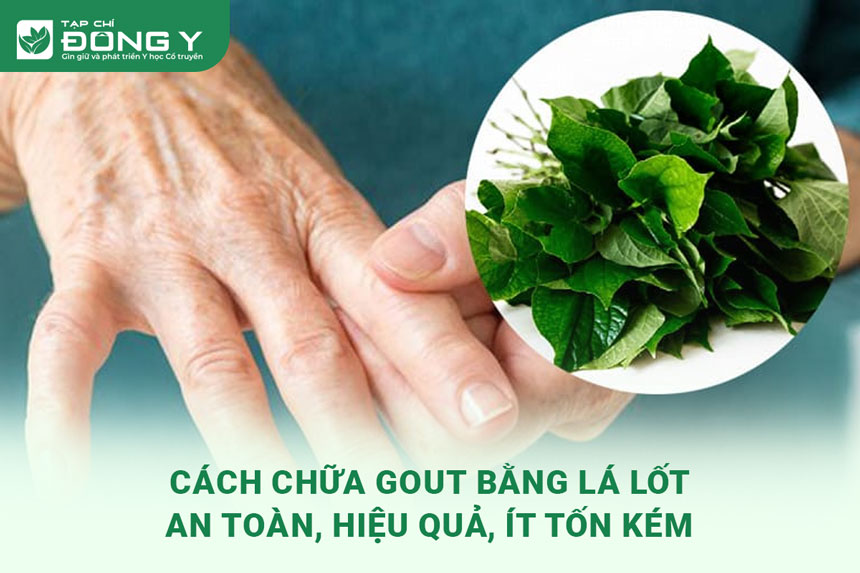 chua-gout-bang-la-lot