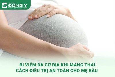 viem-da-co-dia-khi-mang-thai