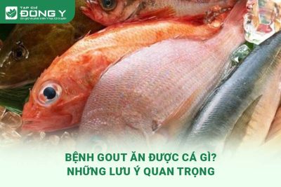 benh-gout-an-duoc-ca-gi