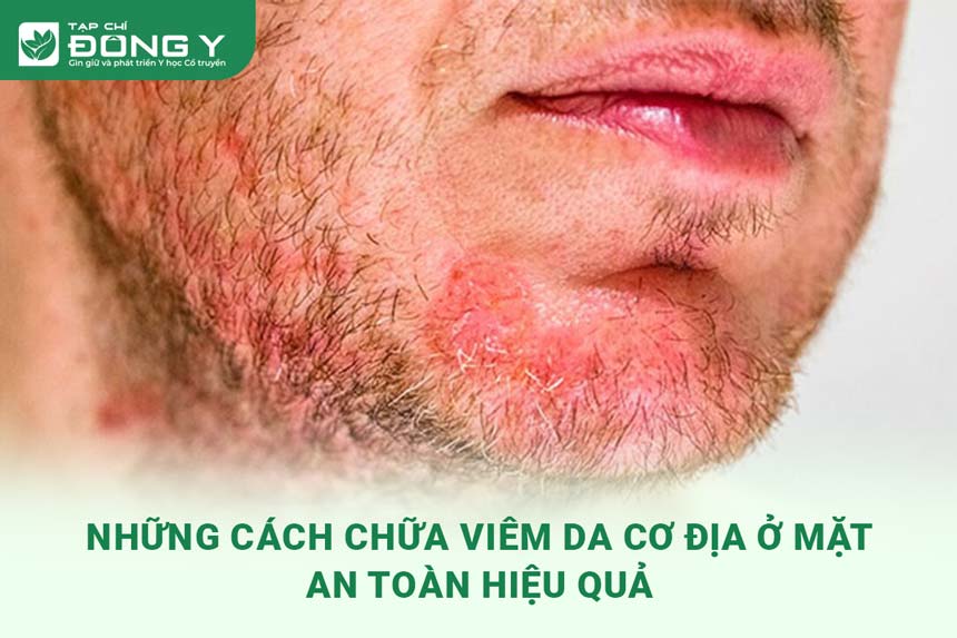 cach-chua-viem-da-co-dia-o-mat