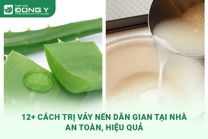 cach-tri-vay-nen-dan-gian-tai-nha
