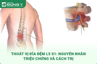 thoat-vi-dia-dem-l5-s1