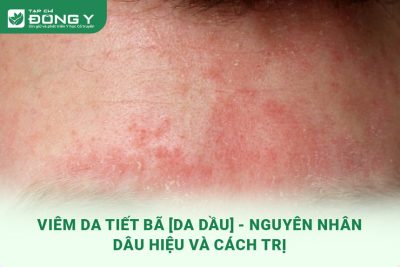 viem-da-tiet-ba