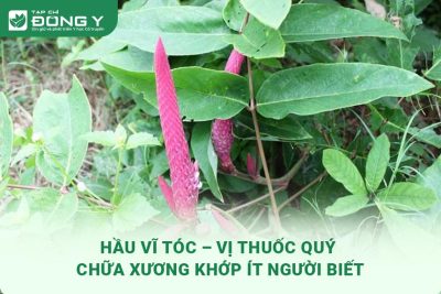 hinh-anh-hau-vi-toc-1