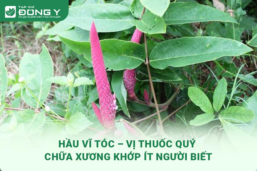 hinh-anh-hau-vi-toc-1