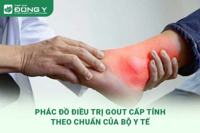 phac-do-dieu-tri-gout-cap