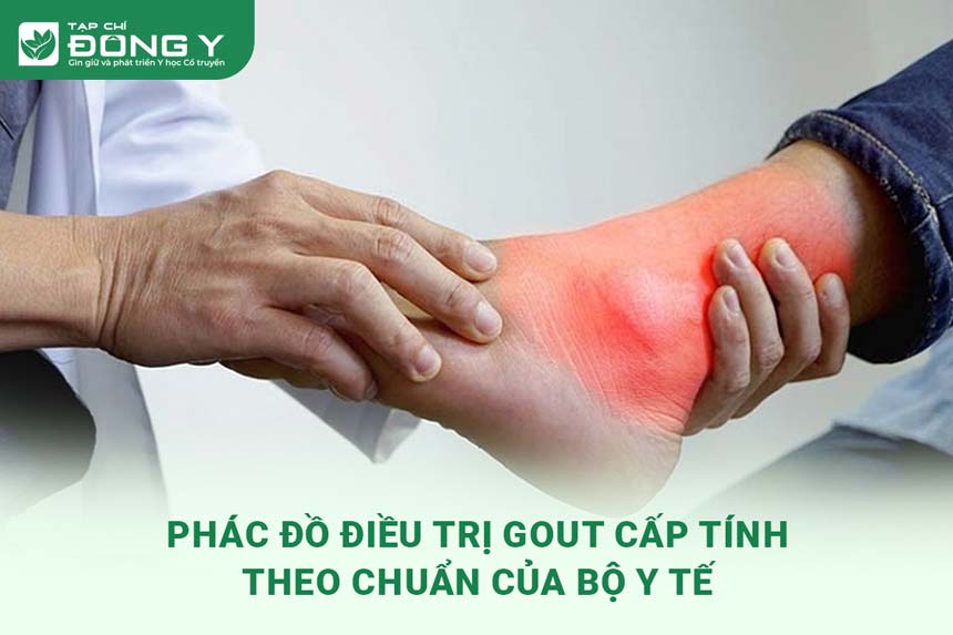 phac-do-dieu-tri-gout-cap