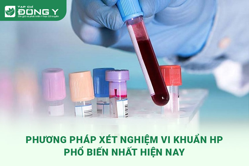 phuong-phap-xet-nghiem-vi-khuan-hp