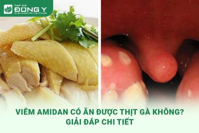 viem-amidan-co-duoc-an-thit-ga-khong