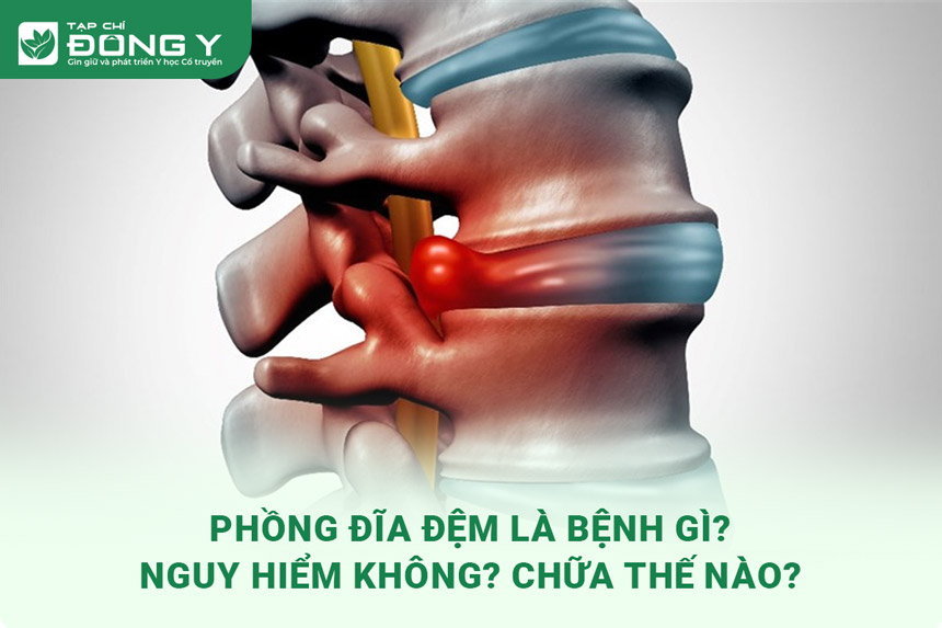 phong-dia-dem
