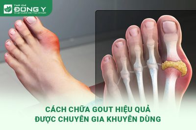 cach-chua-benh-gut