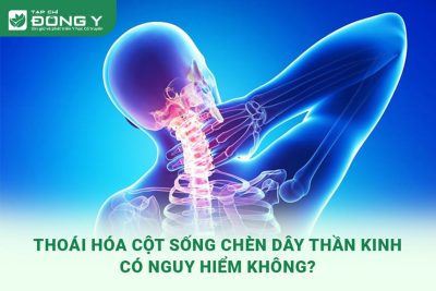 thoai-hoa-cot-song-chen-day-than-kinh