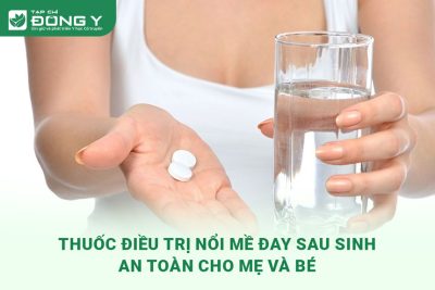 thuoc-dieu-tri-chung-noi-me-day-sau-sinh