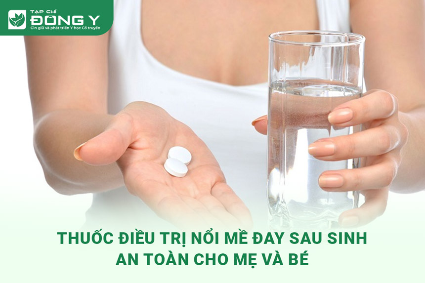 thuoc-dieu-tri-chung-noi-me-day-sau-sinh