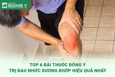 thuoc-dong-y-tri-dau-xuong-khop