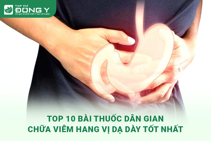 bai-thuoc-dan-gian-chua-viem-hang-vi-da-day