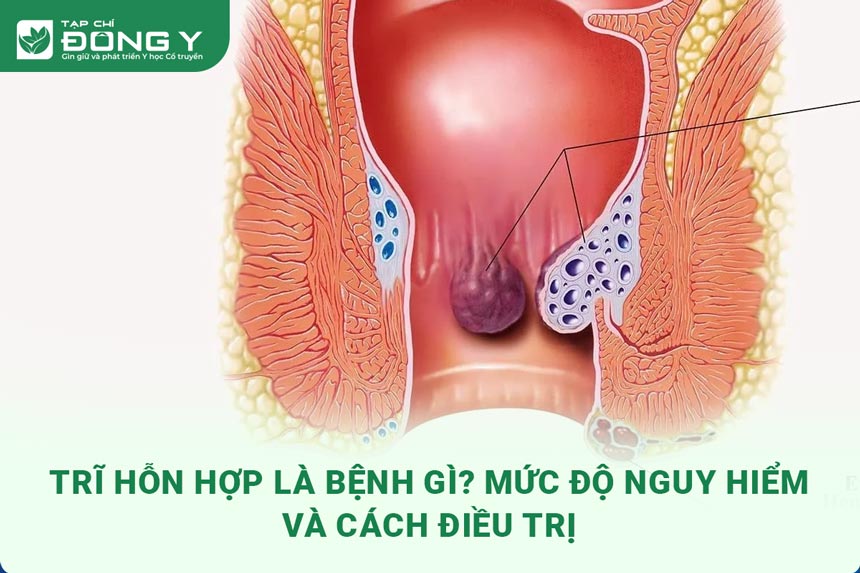 tri-hon-hop