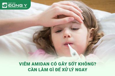 viem-amidan-co-gay-sot-khong