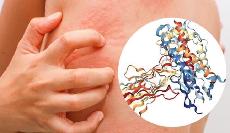 Sự thay đổi hormone có thể gây mẩn ngứa