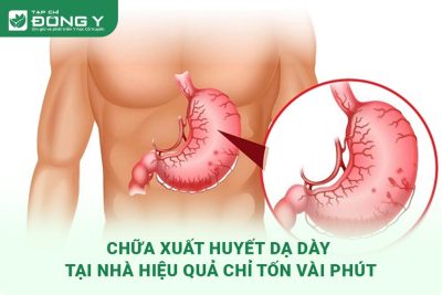 hinh-anh-chua-xuat-huyet-tai-nha-1