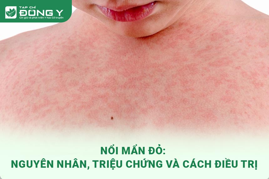 hinh-anh-noi-man-do-1