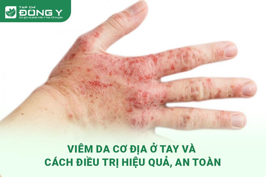 viem-da-co-dia-o-tay