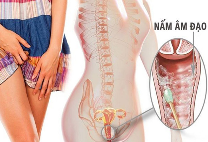 nam-am-dao