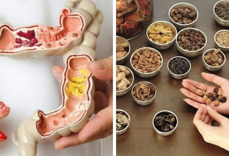 chua-ung-thu-dai-trang-bang-thuoc-nam chua-ung-thu-dai-trang-bang-thuoc-nam