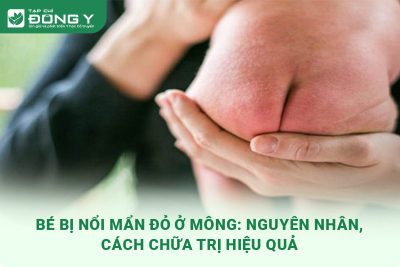 be-bi-noi-man-do-o-mong