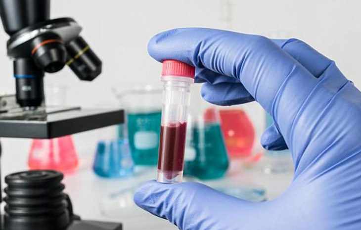 Xét nghiệm này để xác định mức IgE (immunoglobulin E)