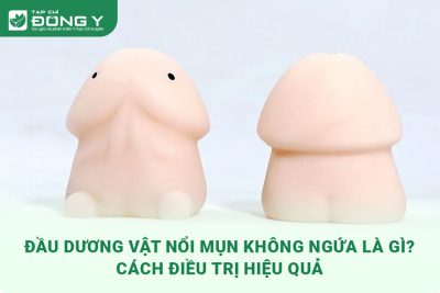 dau-duong-vat-noi-mun-do-khong-ngua