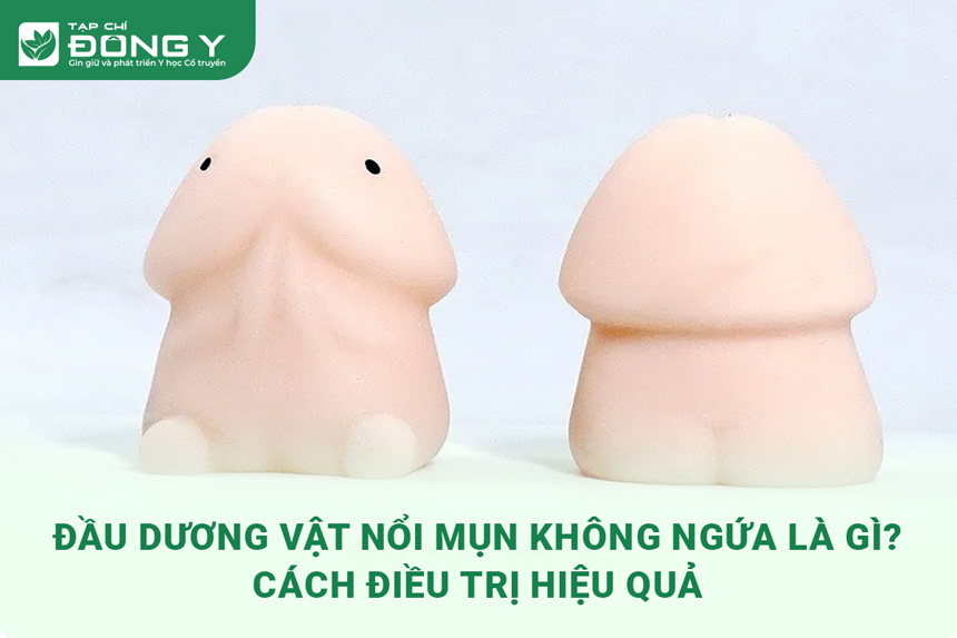 dau-duong-vat-noi-mun-do-khong-ngua