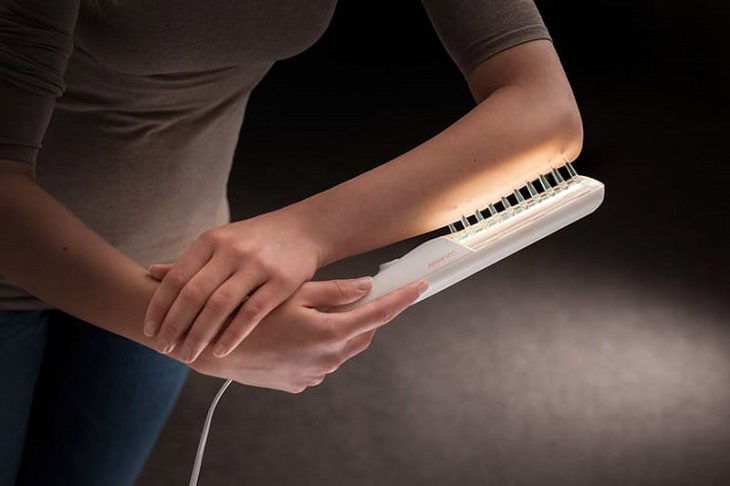Điều trị bệnh vảy nến tại nhà với thiết bị chiếu tia UVB