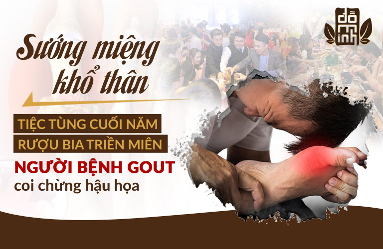 Người bệnh gout thường phải "trả giá" cho những lần nhậu "tới bến" Người bệnh gout thường phải "trả giá" cho những lần nhậu "tới bến"