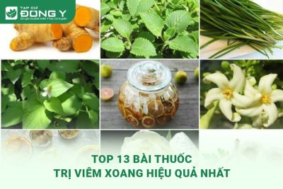 bai-thuoc-tri-viem-xoang