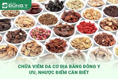 chua-viem-da-co-dia-bang-dong-y