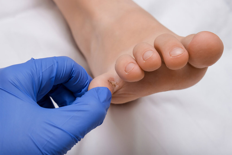Chẩn đoán lâm sàng là bước kiểm tra quan trọng để đánh giá tình trạng bệnh