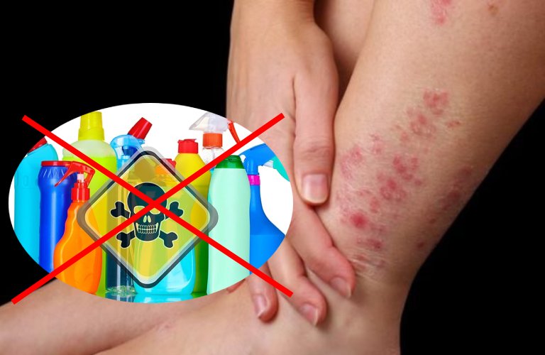 Tránh tiếp xúc với các chất kích ứng giúp phòng bệnh viêm da cơ địa hiệu quả