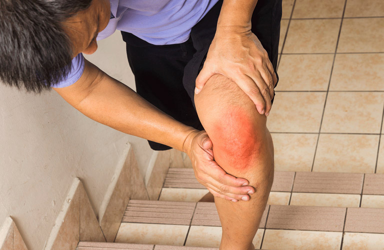 Viêm mao mạch dị ứng biến chứng có thể gây tổn thương khớp