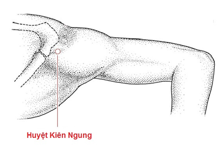 huyet-kien-ngung