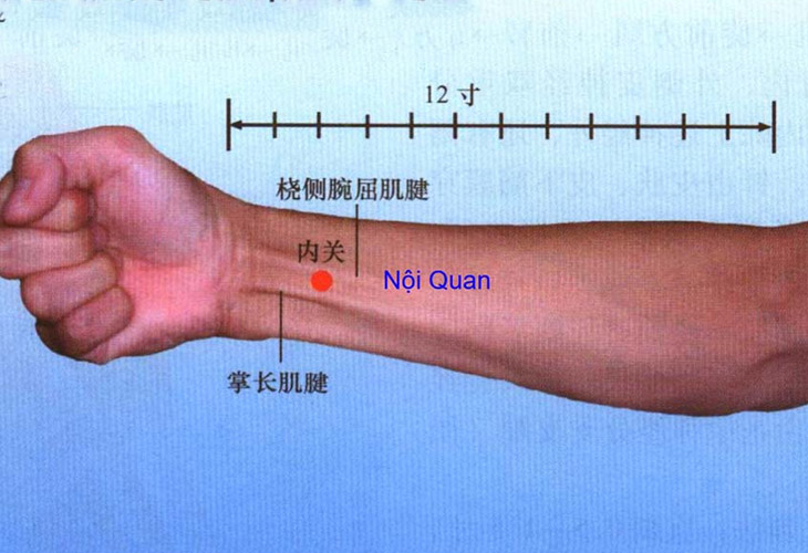 huyet-noi-quan