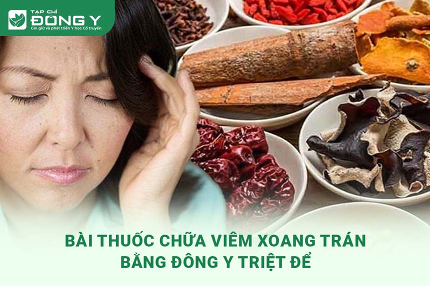 bai-thuoc-chua-viem-xoang-tran-bang-dong-y